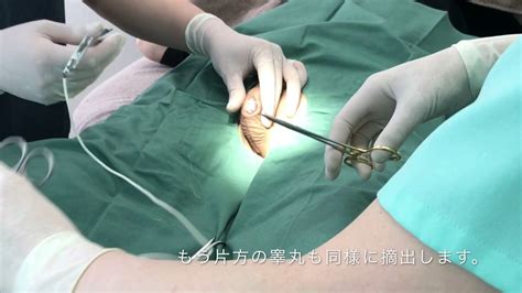 性転換大腸法|MtF手術（男性から女性）SRS（性別適合手術／性転換）｜陰嚢 